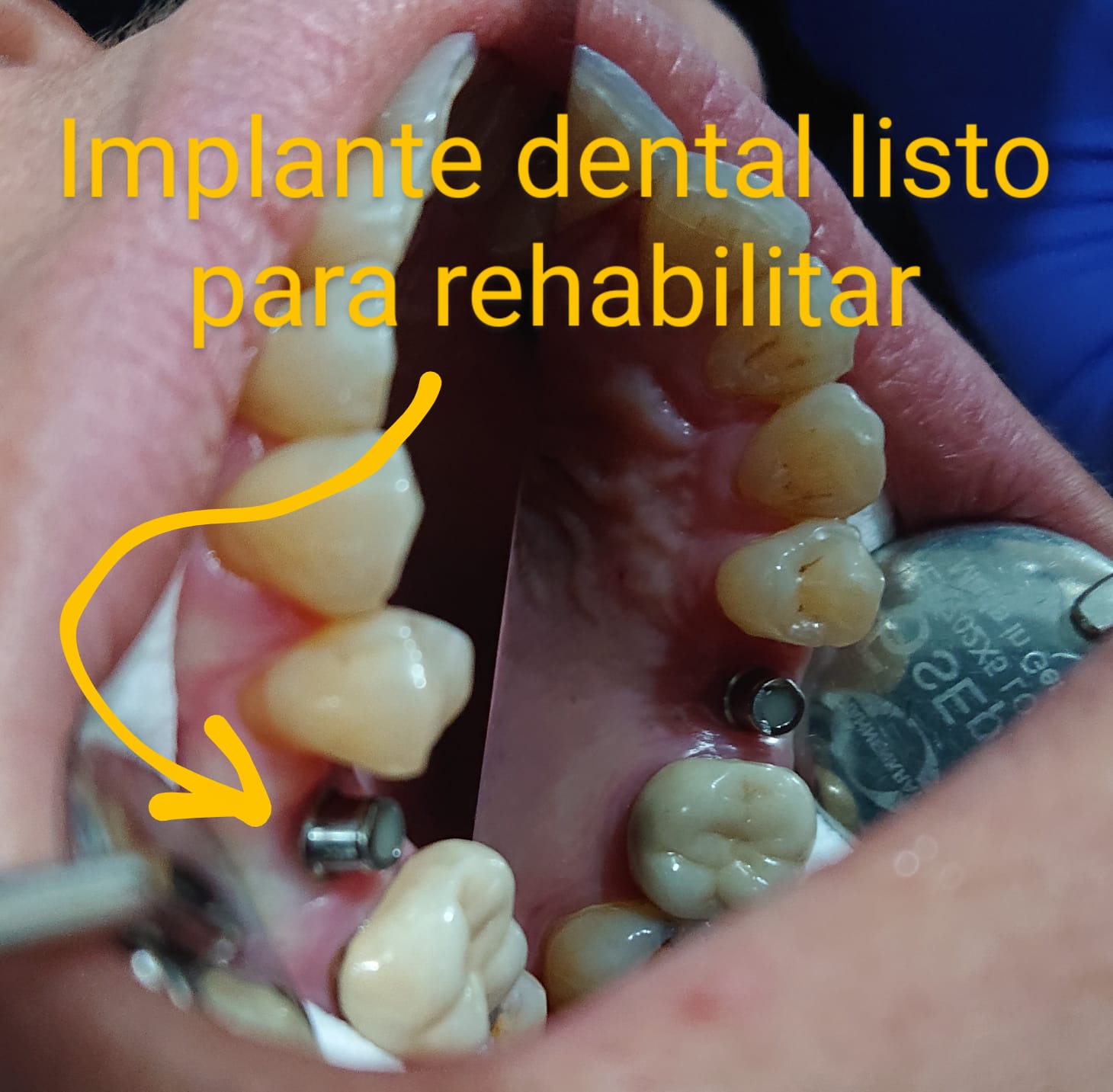 Consultorio de Especialidad Dental en Tlalpan CDMX